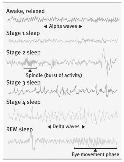 Stages of sleep are defined by EEG a. Stage 1 = alternating periods of alpha and other activity b.
