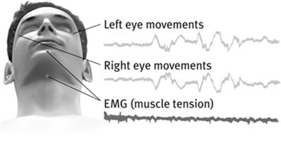 after ~90 minutes, person is obviously asleep, but the EEG resembles waking 2.