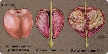 3 Sperm Transport Tubes: 1. Vas deferens 2. Ejaculaory duct 3. Urethra 3 Male Secretory Glands: 1. Seminal vesicles produces: -alkaline mucus (counteract vaginal acidity) Fig 15.