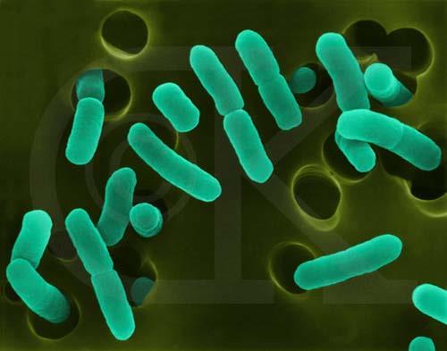 Escherichia coli A prokaryotic, gram negative, unicellular, bacterial cell which can most frequently be found in the large intestine of endothermic animals.