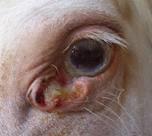 Malignant Eyelid Lesions: Squamous Cell Carcinoma (SCC) Environmental and