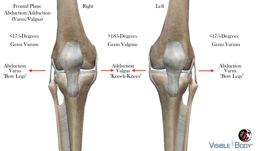 The anterior orientation of both lateral condyles and a 25-30-degree curve on the medial