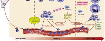 al. Immunol Rev 2011 Schultz-Larsen F, et al. Immunol Allergy Clin North Am 2002 Hanifin JM et al.