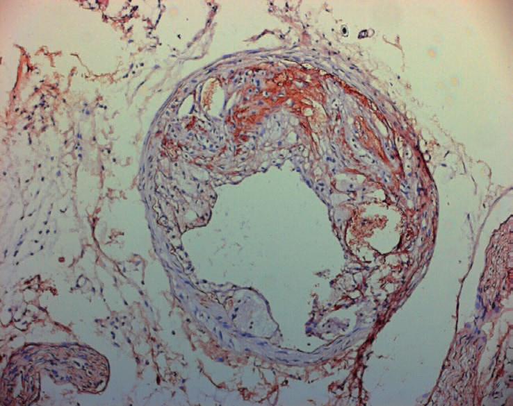 arteries were stained using Keratocan antibody (brown) and Hematoxylin as a counterstaining (blue).