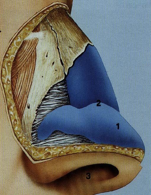 Support Mechanisms Major -Lower lateral cartilage strength -Upper lateral cartilage attachment [scroll] -Medial crural footplateseptal Minor -Dorsal