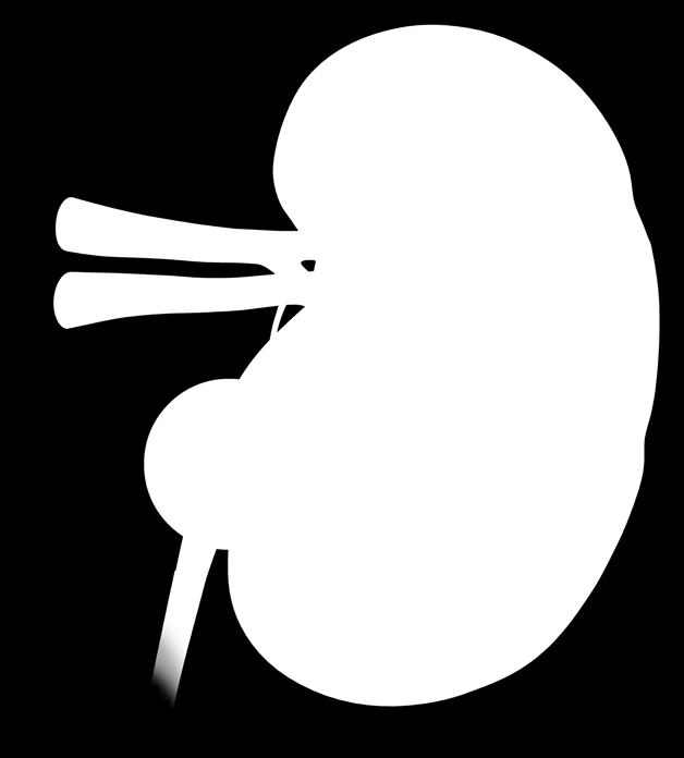 Shock waves are focussed through the skin onto the kidney stone using x-ray or ultrasound images to target and pinpoint them.