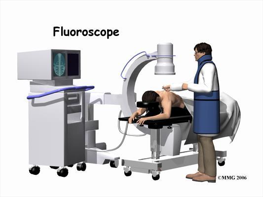 N=100 TEA for thoracotomy Landmark-guided vs fluoroscopic guidance Prone position, on special fluoro table Intermittent imaging used to guide needle LOR to air-saline to detect entry into space