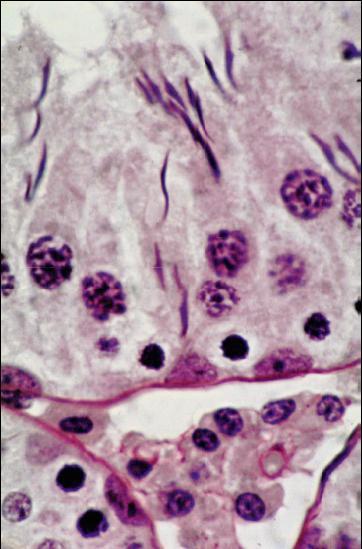 Spermatogenesis: Sperm Production in the Testis Seminiferous tubules Spermatids
