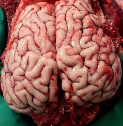 Cerebral Hemispheres (Cerebrum) Paired (left and right) superior parts