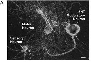 Neurons in in