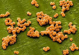 STAPHYLOCOCCUS (Staph) Spread by someone handling food, at warm temps it produces a poison Found on skin, in boils, zits and throat infections Symptoms set in 2-8 hrs after eating