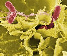 SALMONELLA Undercooked foods such as chicken and eggs.