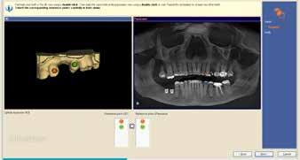 Move through the image and look at the outline of the incisal edges of the digital impression and make sure they