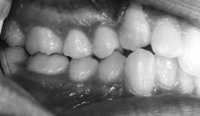 American Journal of Orthodontics and Dentofacial Orthopedics Collett and Fletcher 701 Volume