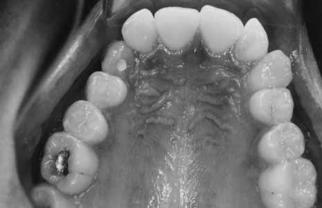 The clinical intraoral presentation is shown in Figs 3 and 4; the radiographic appearance of
