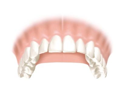 Basic biology and anatomy Tooth loss leads to bone loss