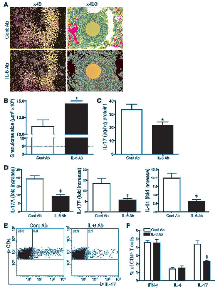 Figure 5 Blockage of IL-6 increases granuloma size and abrogates Th17 phenotype.