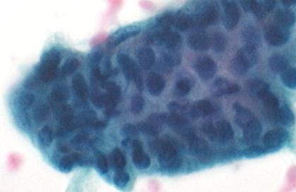 Normal Salivary Gland: Cytology Ductal
