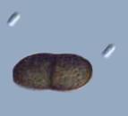 Dothiorella sarmentorum Conidia remained hyaline