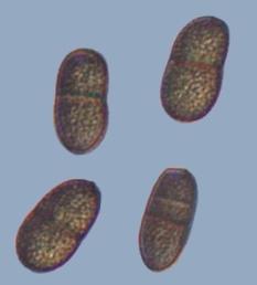 1-3 septate and rough walled after ageing Diplodia