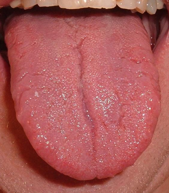 THE TONGUE Occupies floor of mouth Functions include: Articulation