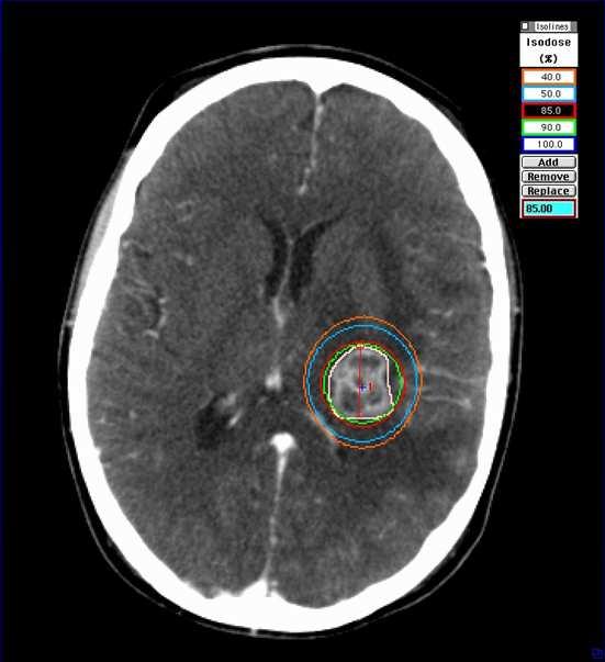 to small, stereotactically defined, intracranial targets in such way