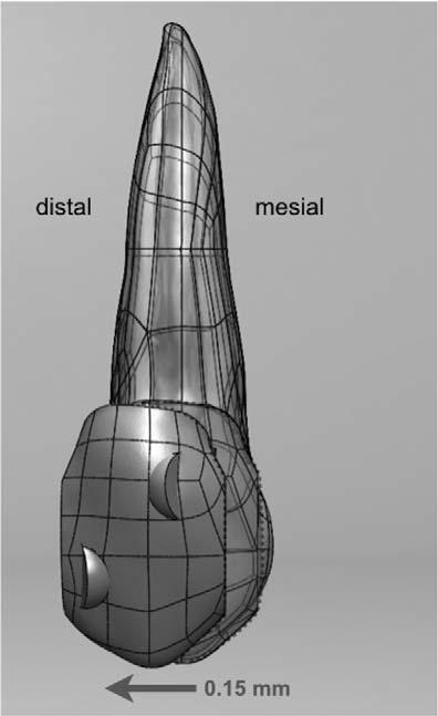 The CAD geometry of bone, PDL, attachments, and aligner was constructed, using a top-down assembly feature of SolidWorksH software, from the CAD model of the tooth, as shown in Figure 2.