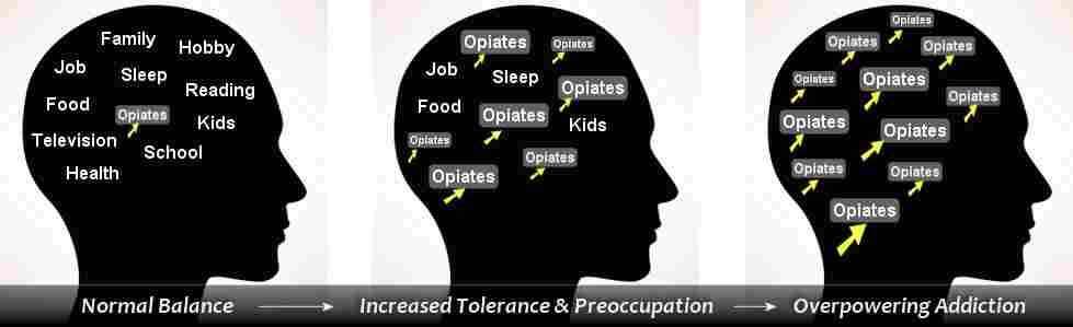 Opioid Painkillers work by binding to opioid receptors in the brain.