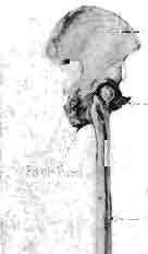 .. Articuldtion ot fibula / / ' /' FIG. 2.17.-Bones of the pelvic appendage, man and cat. (By John F. Trainor.