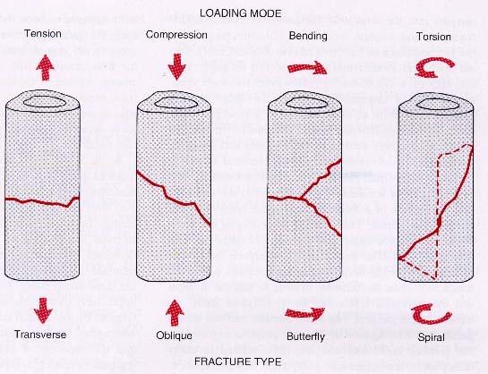 Fracture Mechanics Figure from: Browner et