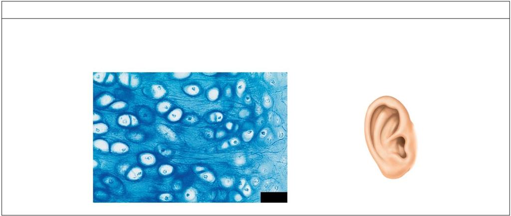 , knees and temporomandibular [jaw] joints) Chondrocyte in lacuna Nucleus Intervertebral disk Collagen fibers in matrix LM 240x (c) Elastic Cartilage Structure: Similar to