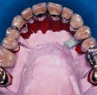 This will include multi-discplinary care in liaison with other specialists, surgeons and physicians, for example management of hypodontia cases with orthodontists or planning the extraction and