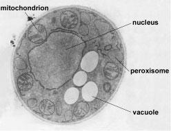 9/21/12 Organelle Comparison kind of Eukaryotes Ribosomes (80s) Nucleus Endoplasmic Re/culum Golgi Apparatus Peroxisomes
