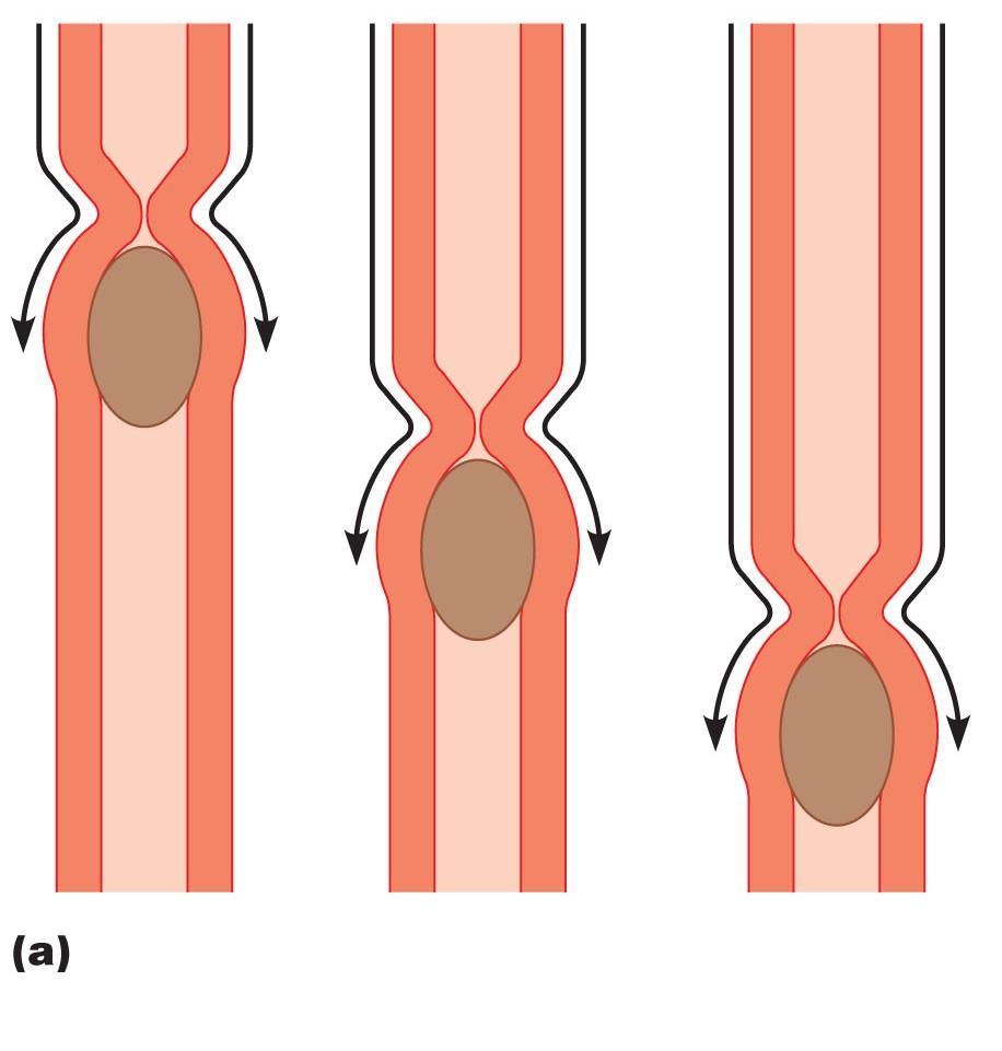 Figure 23.3a Peristalsis and segmentation. From mouth 2013 Pearson Education, Inc.