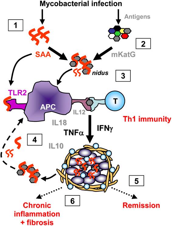 SAA in sarcoidosis 4-SAAas a trap for microbial or autoantigens while soluble SAA, released from tissue granulomas,serves as a ligand for TLR2.