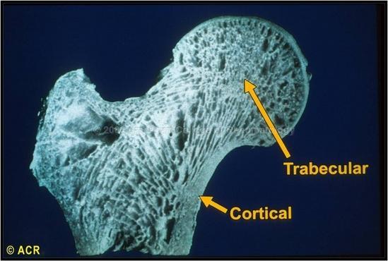 Types of Bone *Cortical (compact) - (80% of skeleton), tightly packed(4x greater mass), slower turnover (8x).