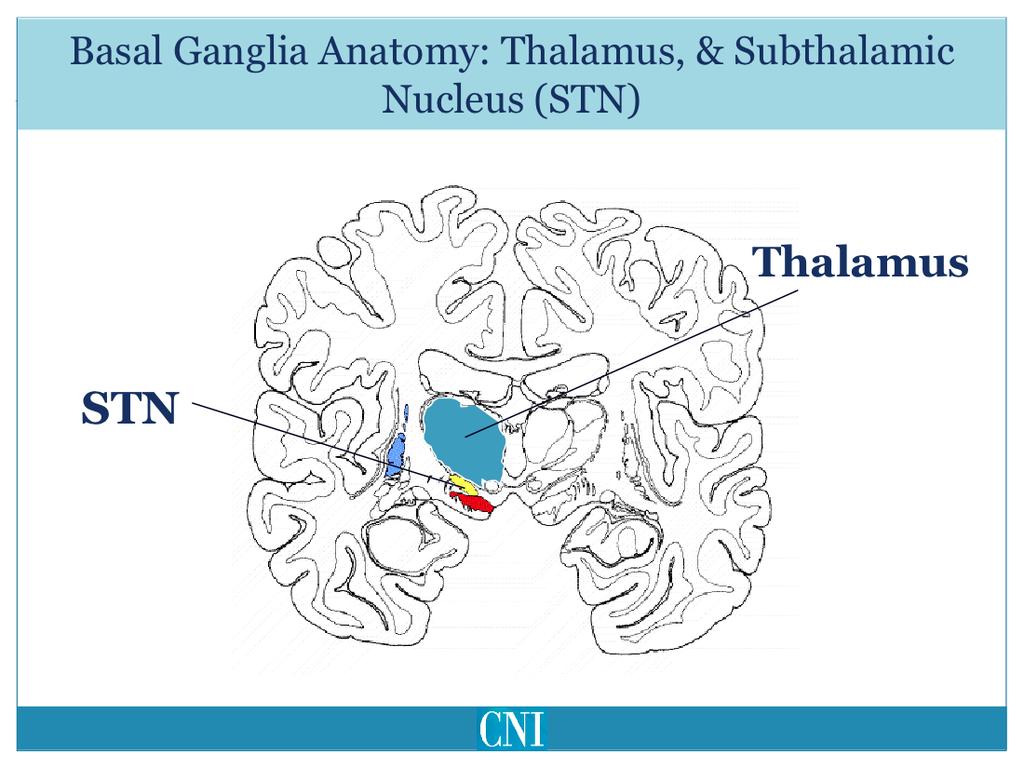 More recently, the subthalamic nucleus has been used as a surgical target for deep brain s,mula,on for dystonia.