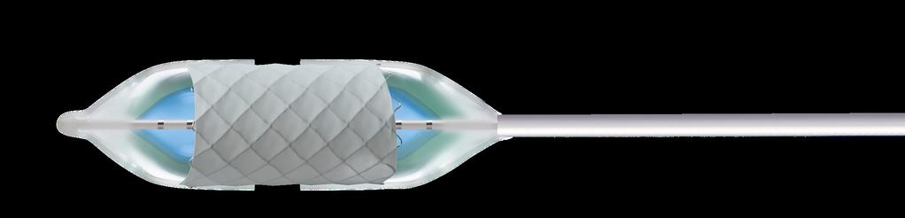 COVERED MOUNTED CP STENT Ordering Information: Covered CP Pre-Mounted on a BIB Catheter Rated Rated Burst Pressure (number of zigs) Profile 12 2.5 7 6 1.5 5 8 12 1.6 614350 12 2.5 7 6 1.5 5 8 12 2.
