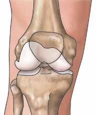The surface of the kneecap, thigh bone and shin bone, where the bones come in contact, is coated with a