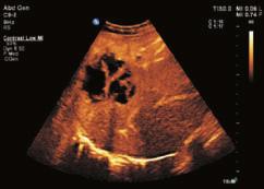 Among leading ultrasound manufacturers, Philips offers the world s only live 3D images