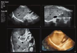 fetus 3D panoramic imaging xmatrix