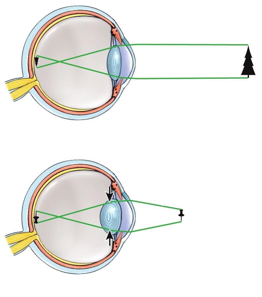 MAJOR PROCESSES OF IMAGE o Refraction of light (bending) by cornea & lens light rays must fall upon the retina o Accommodation of the lens FORMATION changing shape of lens so that