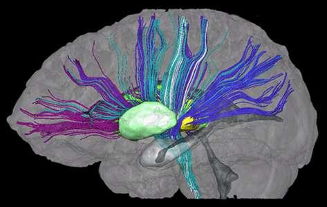 cortex of cerebral