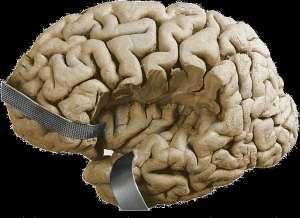 lobe occipital lobe insular