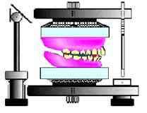 the trial denture