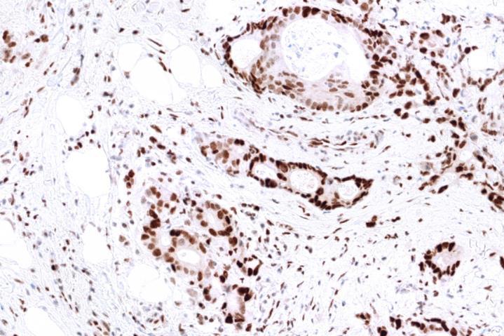 Intact Status tissue exhibits strong nuclear staining in