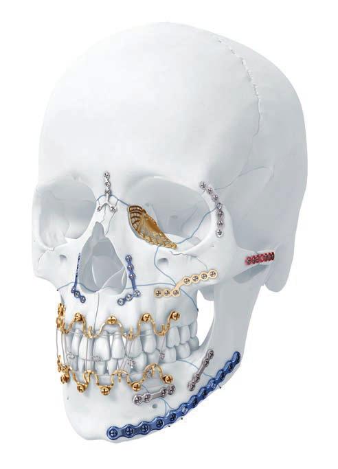 MATRIX PLATFORM FEATURES DESIGNED TO COMPLEMENT AO FIXATION PRINCIPLES The aim of surgical fracture treatment is to reconstruct the bony anatomy and restore its function.