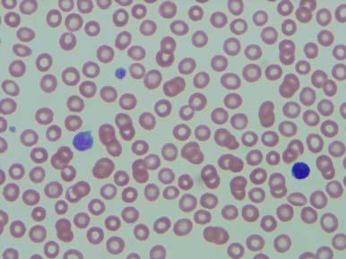 platelets, prolonged bleeding time,