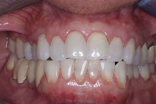 over 25 years, we can show you a similar case with spectacular results! Dr.