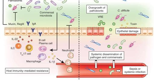 Sepsis and Intestinal Dysbiosis As shown in the right image, in the healthy gut, commensal microbiota suppresses the proliferation and colonization of enteric pathogens.